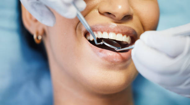 Best Emergency Dental Filling Replacement  in College Place, WA