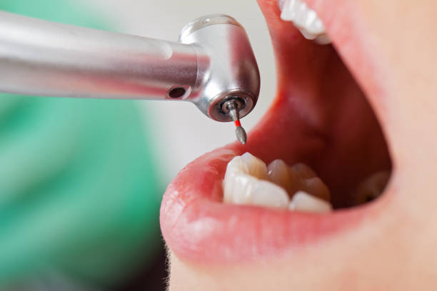 Best Knocked-Out Tooth Emergency  in College Place, WA